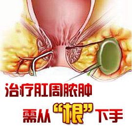 肛周脓肿.jpg